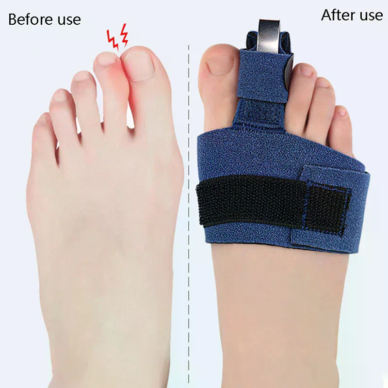 1Pcs Toe Corrector Toe Fractur - Ankle Brace Sock review and price